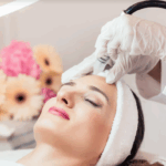 Ultherapy Prime: tecnologia avançada para lifting facial sem cirurgia